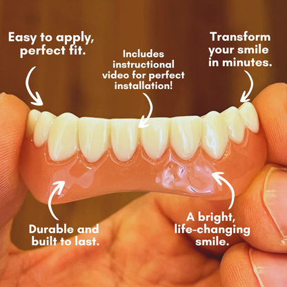 Dental Veneers